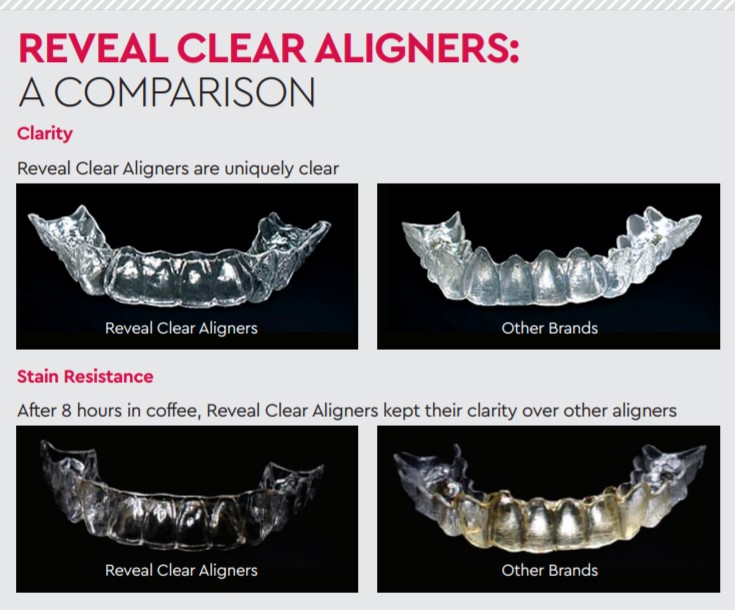 reveal clear aligners a comparison